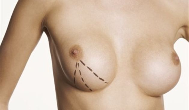 Grudi; Estetski zahvati (Tportal.hr)