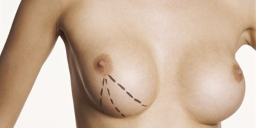 Grudi; Estetski zahvati (Tportal.hr)