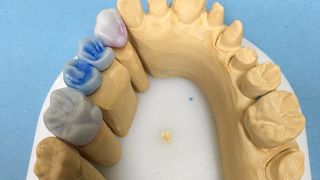 Natjecanje budućih dentalnih tehničara “Schola Medica 2016.” u Medicinskoj školi Ante Kuzmanić