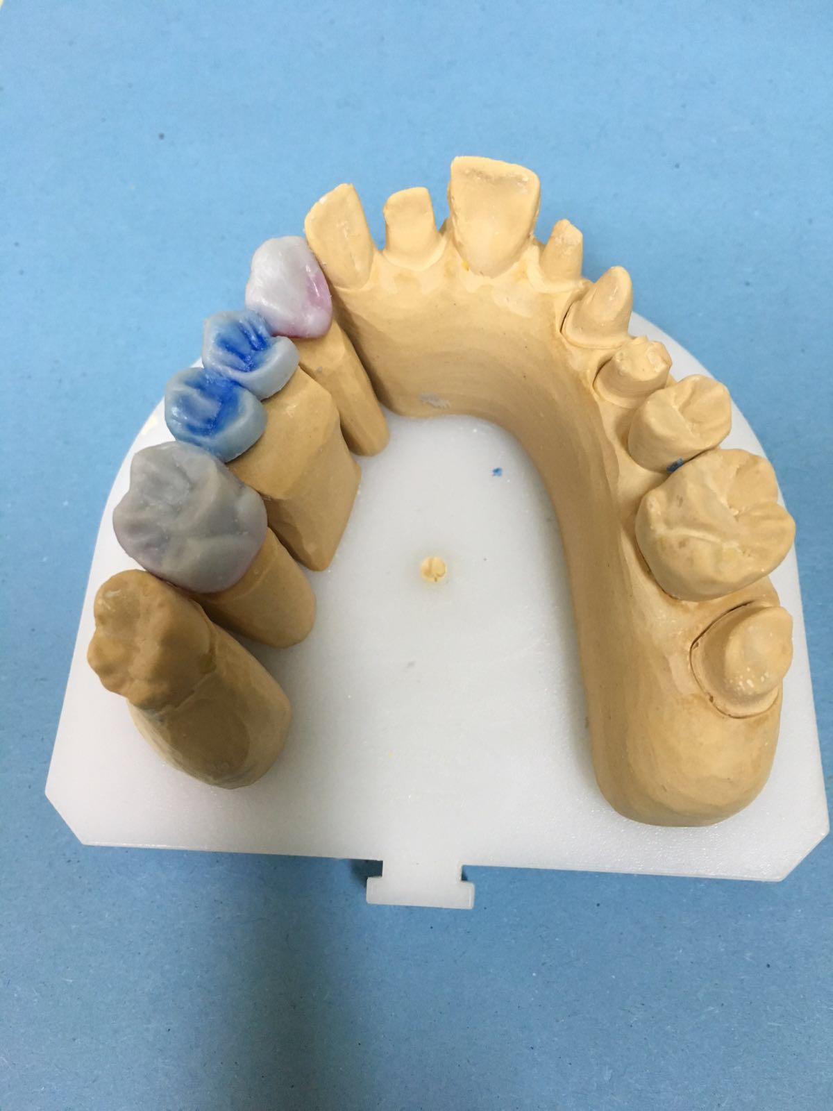 Natjecanje budućih dentalnih tehničara “Schola Medica 2016.” u Medicinskoj školi Ante Kuzmanić
