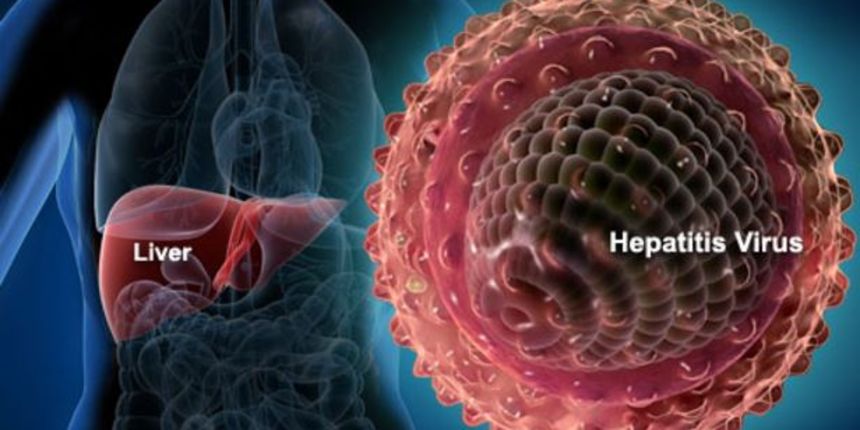 Hepatitis Hepatitis