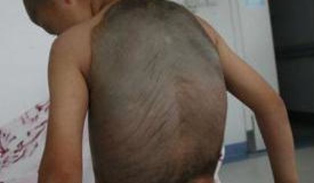 Dječak kornjača (Metro-portal.hr)