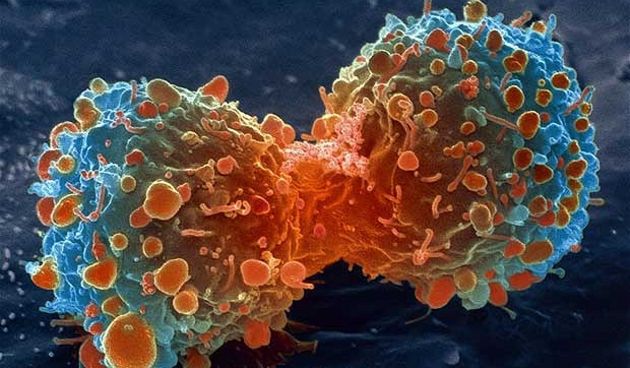 Rak, karcinom, foto: www.telegraph.co.uk