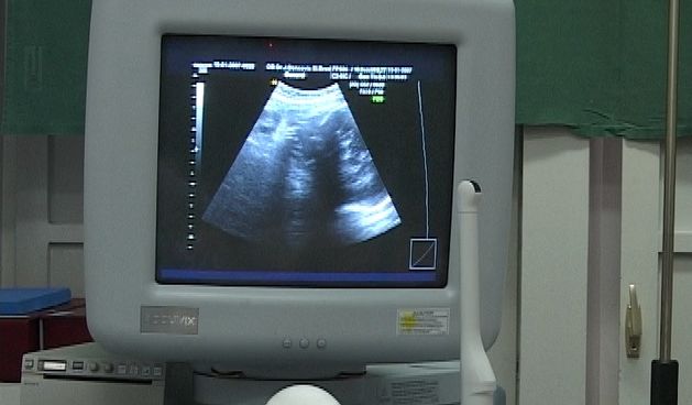 Novi ultrazvuk u šibenskoj bolnici (Foto: Doagoj Zovko)