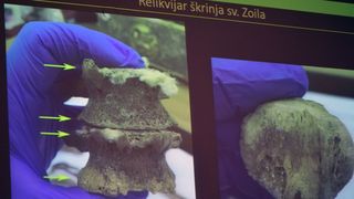 Otkrivene tajne relikvija zadarskih zaštitnika Otkrivene tajne relikvija zadarskih zaštitnika