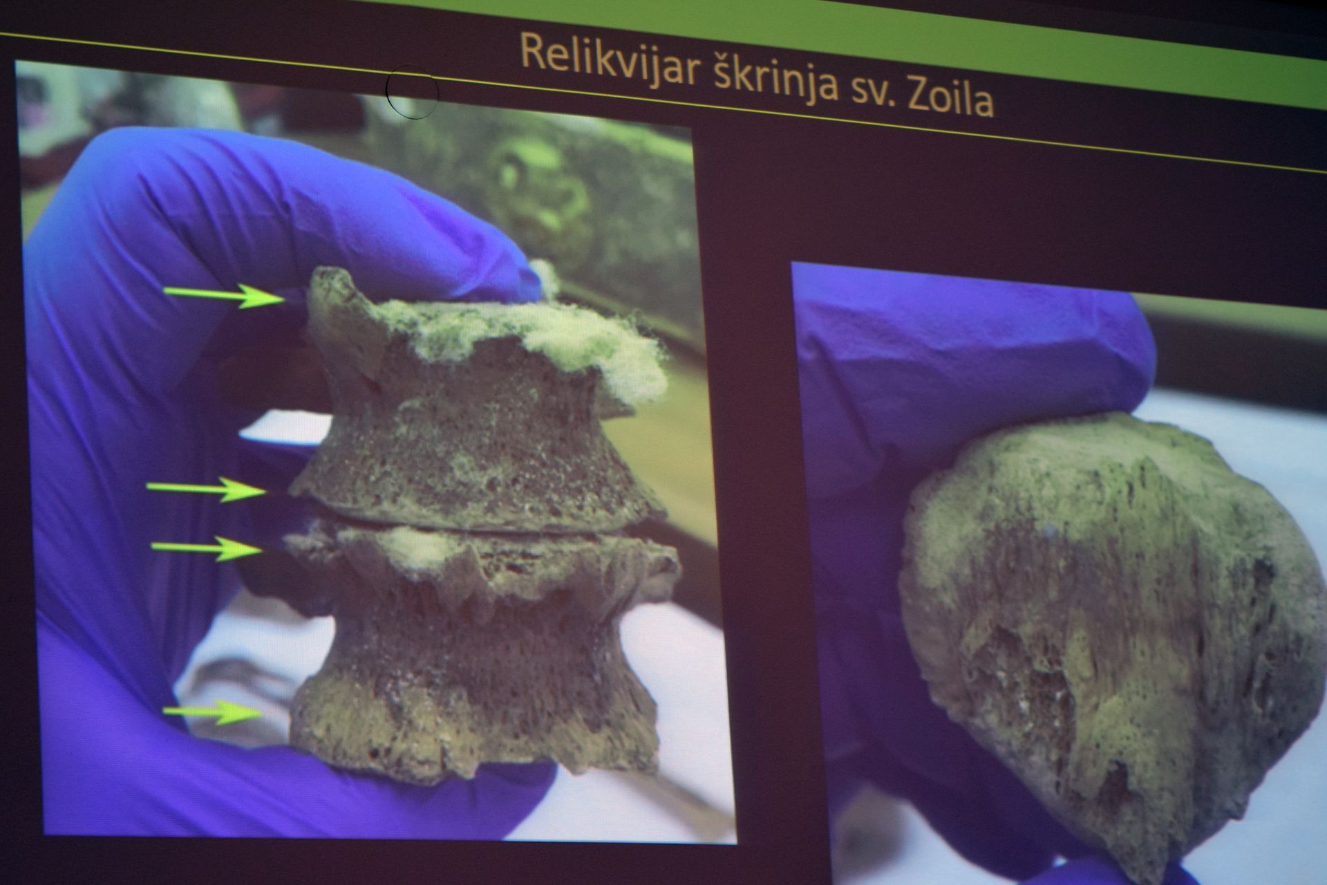 Otkrivene tajne relikvija zadarskih zaštitnika Otkrivene tajne relikvija zadarskih zaštitnika