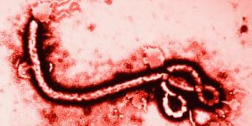 Ebola, foto: www.cidrap.umn.edu Ebola, foto: www.cidrap.umn.edu