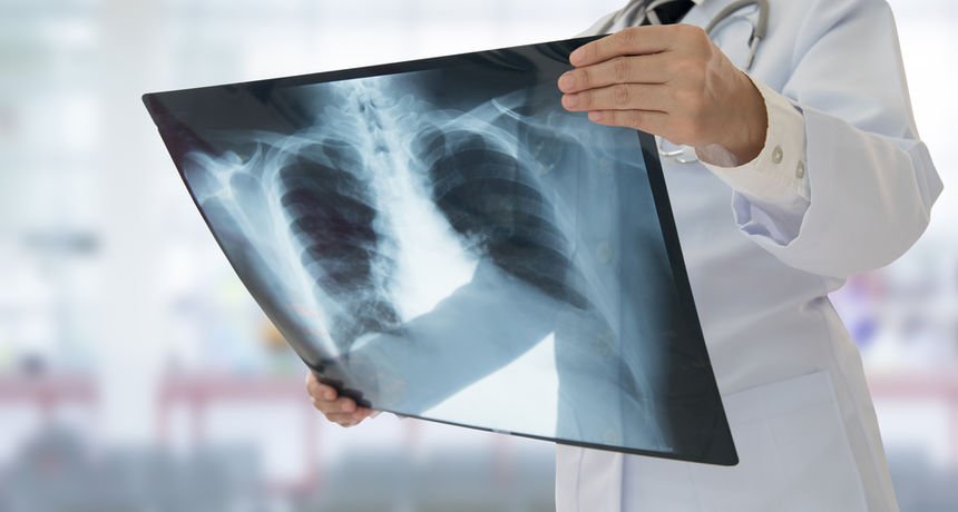 Silicij i zračenje Silicij i zračenje