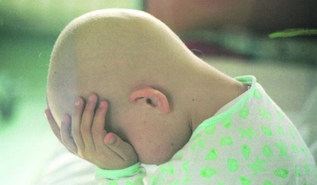 Leukemija, foto: novinenovosadske.rs