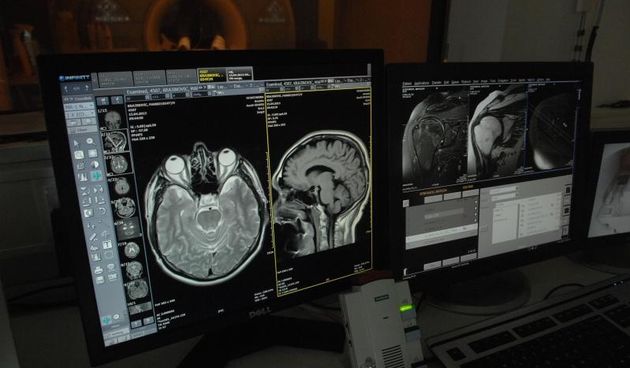 ez obzira sto privatna bolnica Sv. Katarina od 1. ozujka vise nema ugovor s Hrvatskim zavodom za zdravstveno osiguranje, pacijenti iz OB Zabok u kojoj je i smjestena bolnica Sv. Katarina mogu dolaziti na magnetnu rezonancu.