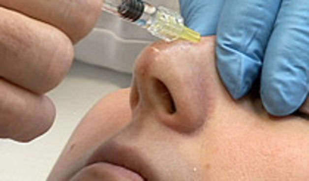 plastična operacija nosa