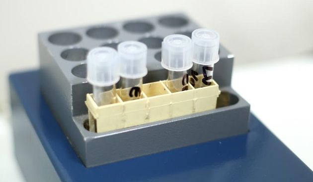 Zagreb – Otvorenje novog IVF laboratorija u Klinici za zenske bolesti i porode KBC-a Zagreb.