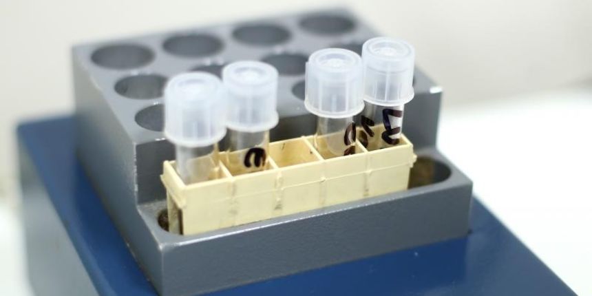 Zagreb – Otvorenje novog IVF laboratorija u Klinici za zenske bolesti i porode KBC-a Zagreb. Zagreb – Otvorenje novog IVF laboratorija u Klinici za zenske bolesti i porode KBC-a Zagreb.