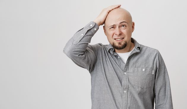 Ćelavost, ćelavi muškarac