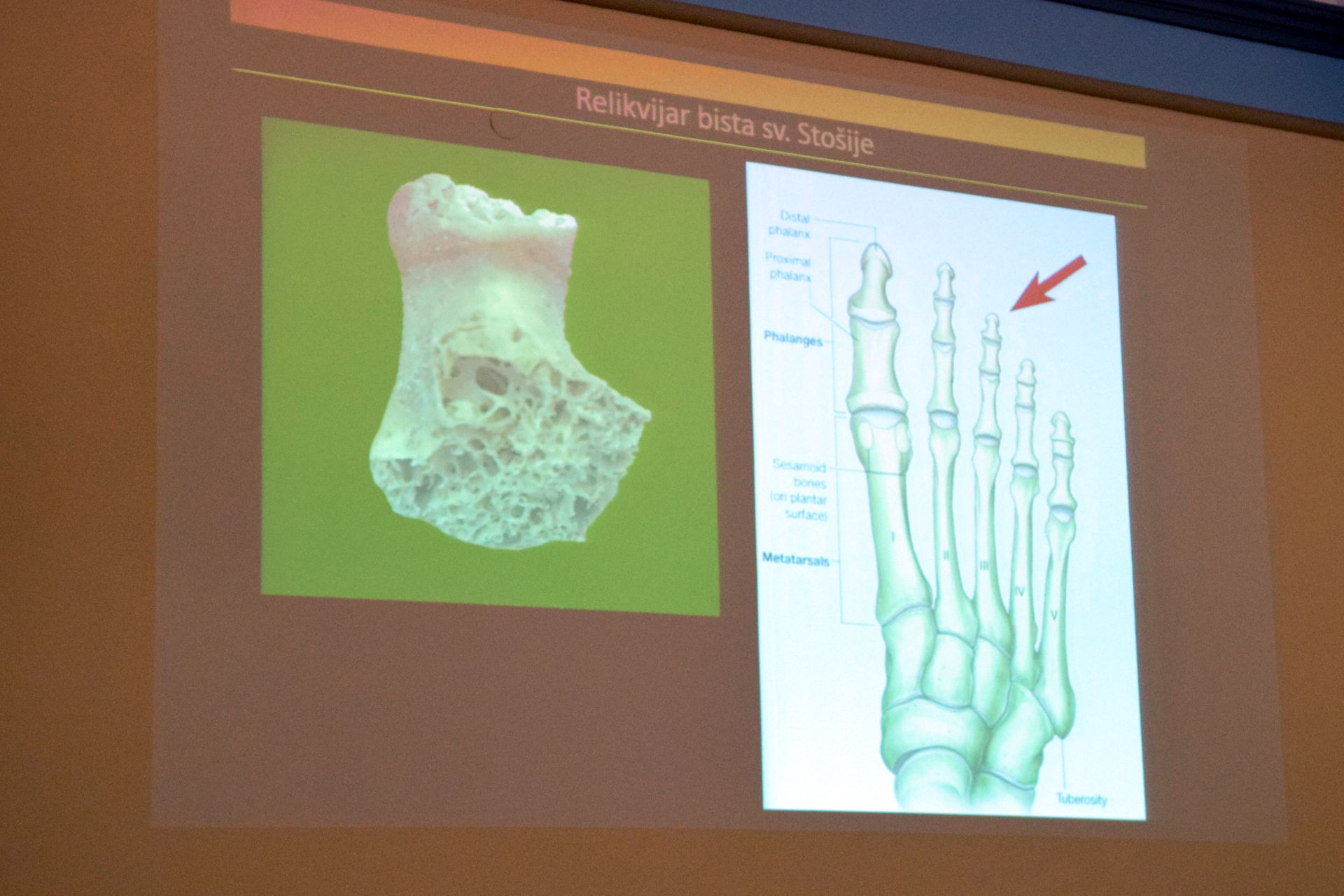 Otkrivene tajne relikvija zadarskih zaštitnika Otkrivene tajne relikvija zadarskih zaštitnika