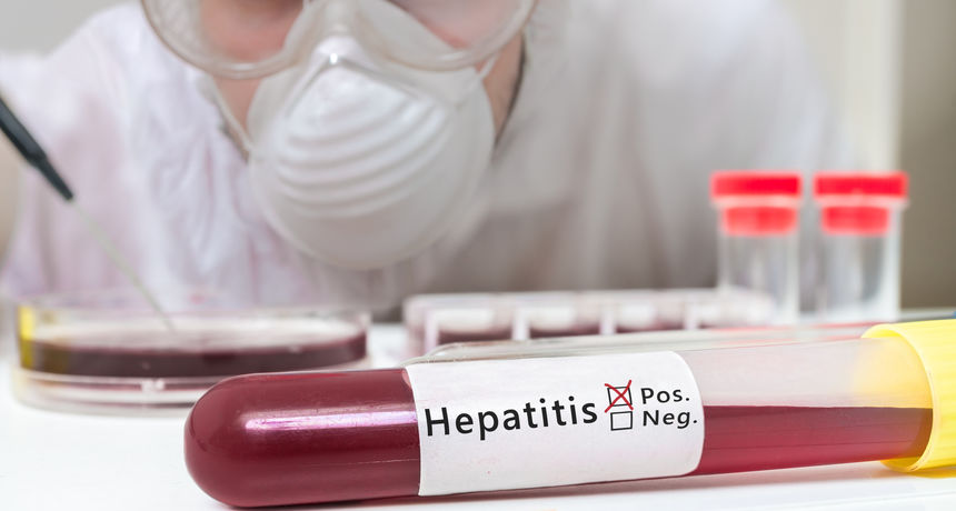 hepatitis
