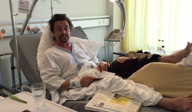 Richard Hammond iz bolnice
