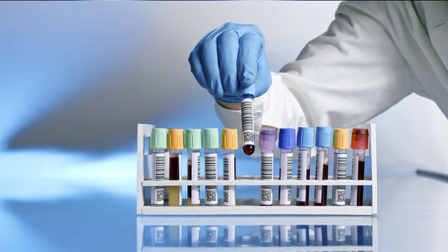 Krvna plazma, Bolnica, Doktori, Laboratorij