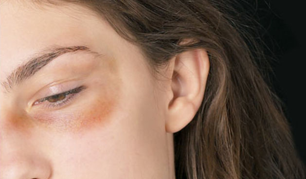 Nasilje nad ženama/Foto: thephoenix.com