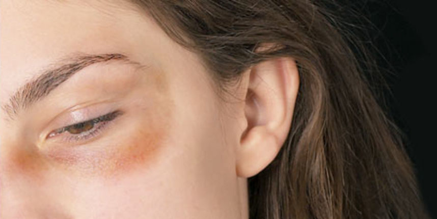 Nasilje nad ženama/Foto: thephoenix.com Nasilje nad ženama/Foto: thephoenix.com