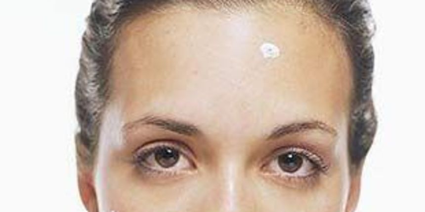 akne, prištići akne, prištići