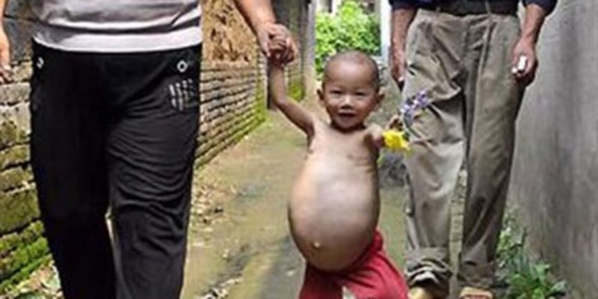 Jednogodišnja djevojčica u trbuhu ima bebu (Tportal.hr) Jednogodišnja djevojčica u trbuhu ima bebu (Tportal.hr)