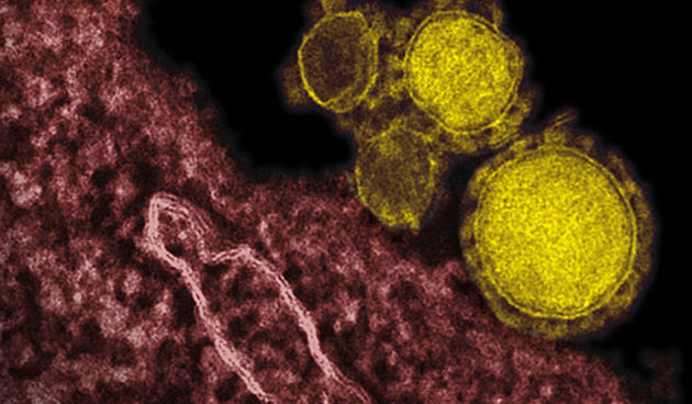 MERS virus