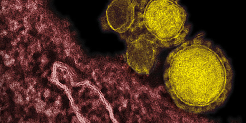 MERS virus