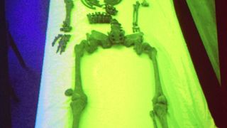 Otkrivene tajne relikvija zadarskih zaštitnika Otkrivene tajne relikvija zadarskih zaštitnika