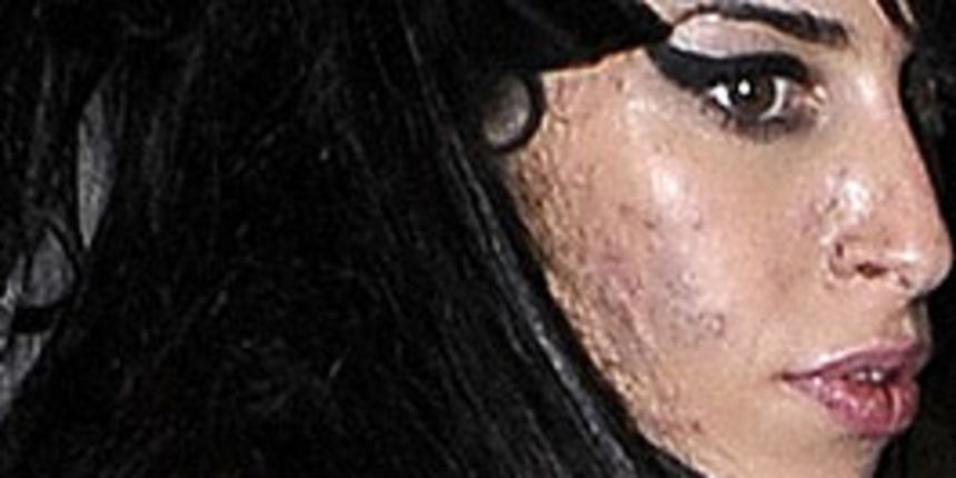 Amy Winehouse (Foto: tportal) Amy Winehouse (Foto: tportal)