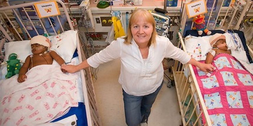 Djevojčice Trishna i Krishna (Foto: brisbanetimes.com.au) Djevojčice Trishna i Krishna (Foto: brisbanetimes.com.au)