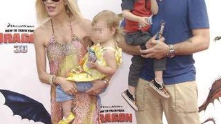 Nezdravo mršave celebrity dame