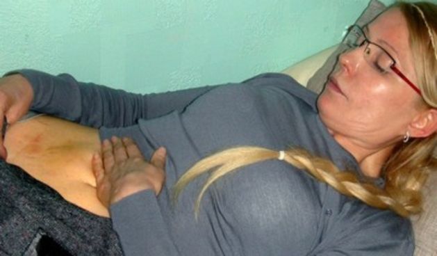 Timošenko i dalje štrajka glađu, foto: HRT