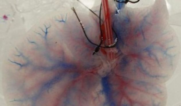 Jetra (Metro-portal.hr)