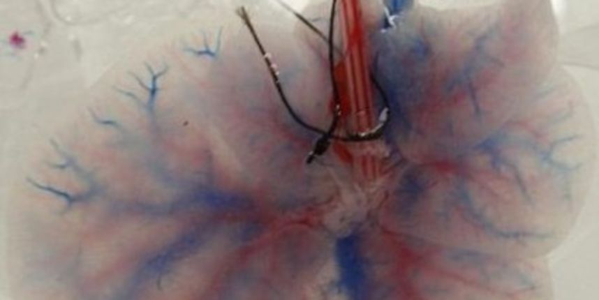 Jetra (Metro-portal.hr) Jetra (Metro-portal.hr)