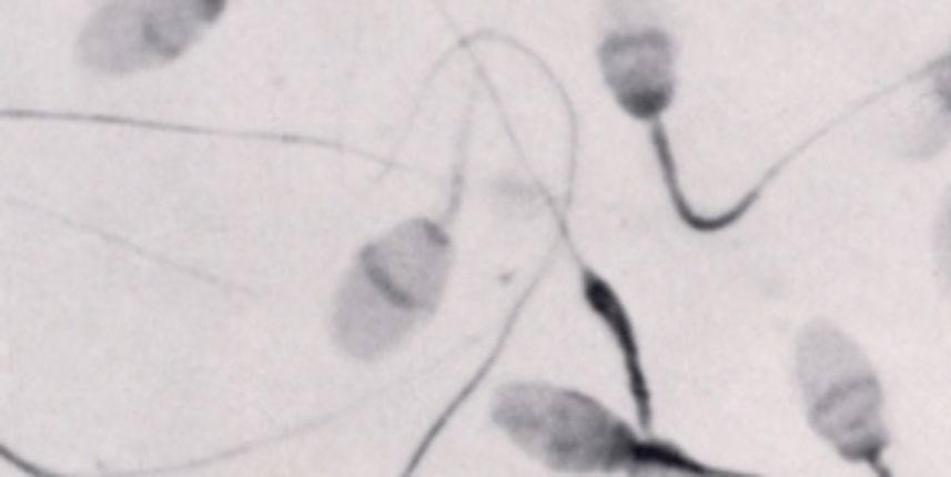 Sperma (Index.hr) Sperma (Index.hr)