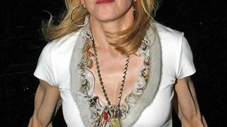 Nezdravo mršave celebrity dame