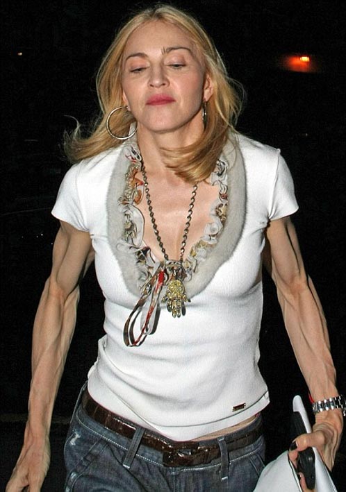 Nezdravo mršave celebrity dame