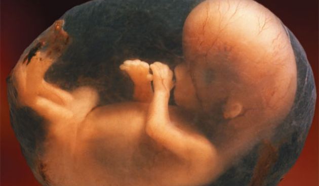 Fetus, Ilustracija: Wikimedia