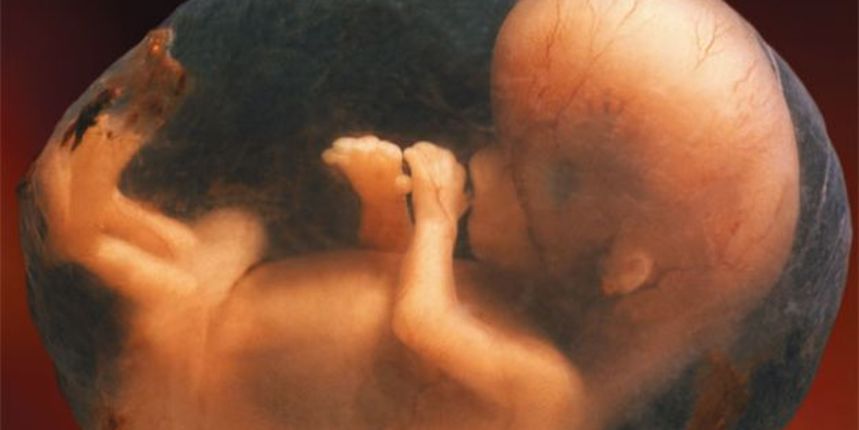 Fetus, Ilustracija: Wikimedia Fetus, Ilustracija: Wikimedia