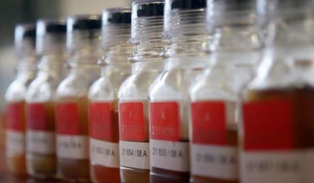 Doping kontrola – uzorci