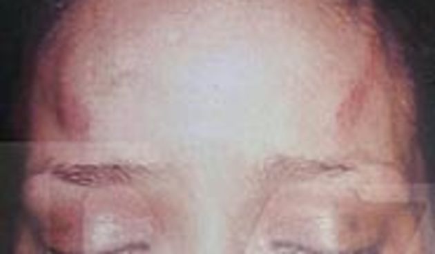 Premlaćena Rihanna (Foto: timesonline.co.uk)