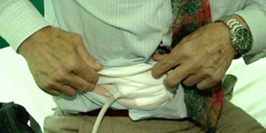 Umjetno srce Umjetno srce