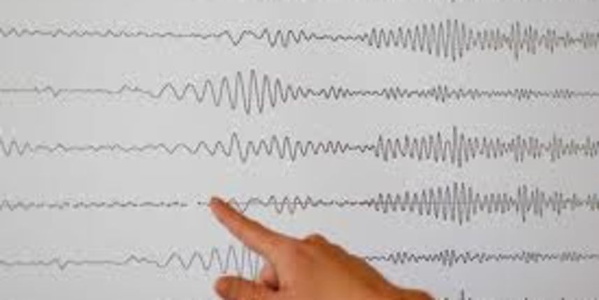 Image 378377 (auto) Image 378377 (auto)