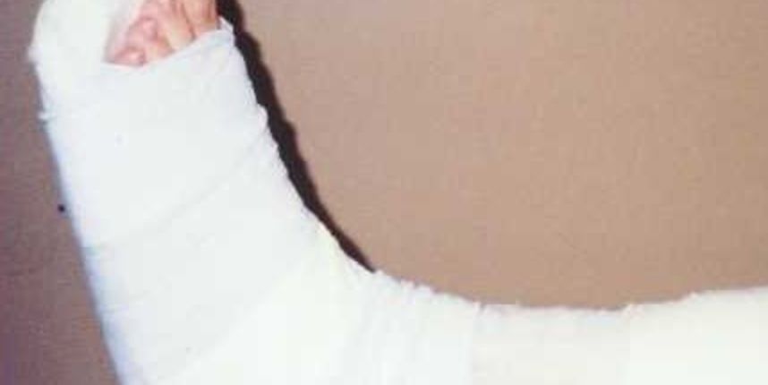 Gips (Foto: miwa-racing.de) Gips (Foto: miwa-racing.de)