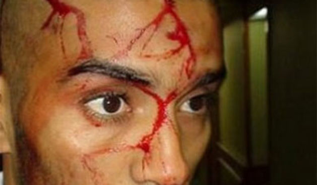 Kamenovanje reprezentacije Ažira u Egiptu