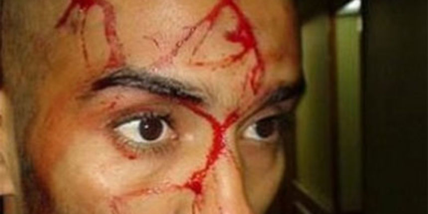 Kamenovanje reprezentacije Ažira u Egiptu Kamenovanje reprezentacije Ažira u Egiptu