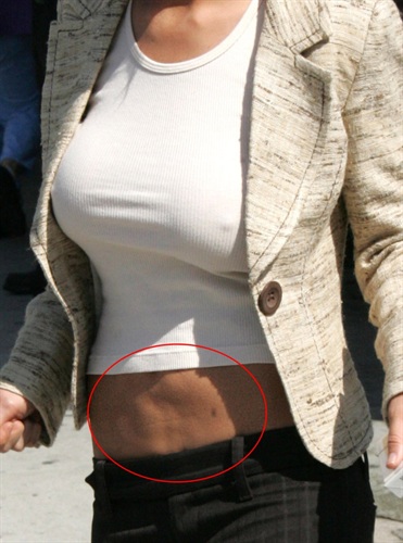 Tara Reid, žrtva plstičnih operacija (Index.hr)