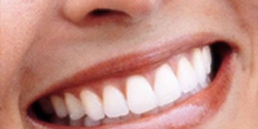 Lijepi zubi, foto: drqurneh.com