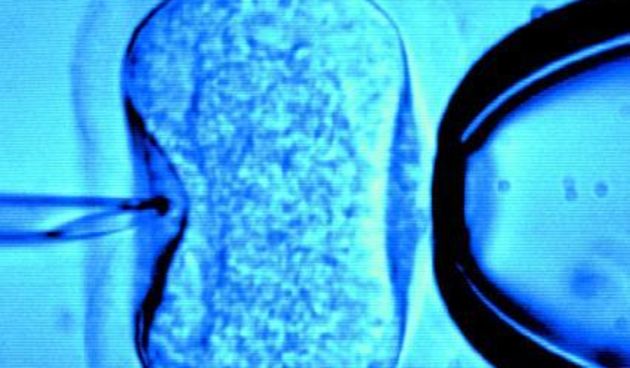 umjetna oplodnja – in vitro